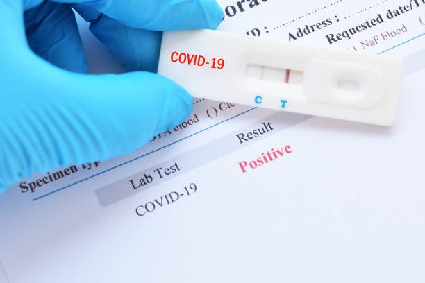 PCR Kits supplied by Relabs DNA Kenya
